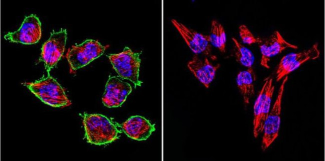 Prolactin Receptor Antibody in Immunocytochemistry (ICC/IF)