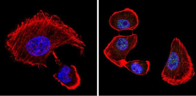 VDR Antibody in Immunocytochemistry (ICC/IF)