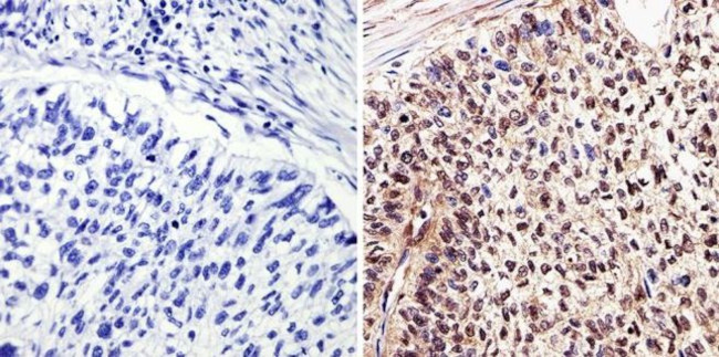 c-Myc Antibody in Immunohistochemistry (Paraffin) (IHC (P))