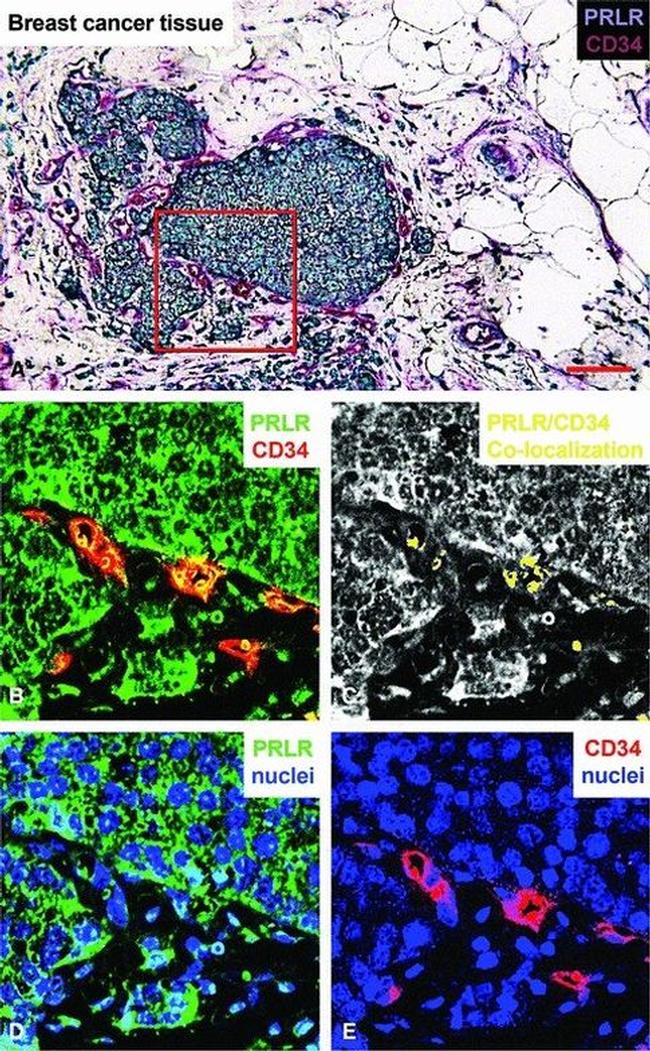 Prolactin Receptor Antibody in Immunohistochemistry (IHC)