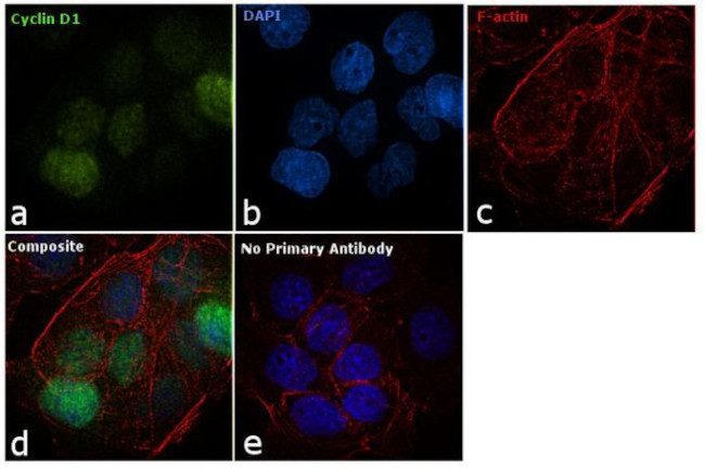 Cyclin D1 Antibody in Immunocytochemistry (ICC/IF)