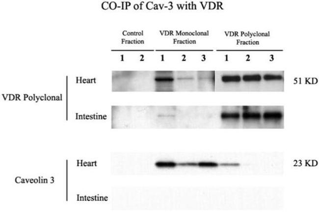 VDR Antibody in Western Blot, Immunoprecipitation (WB, IP)