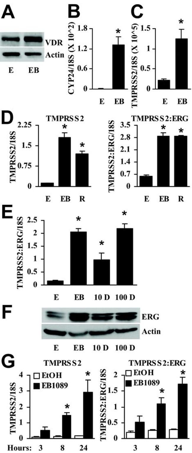 VDR Antibody in Western Blot (WB)