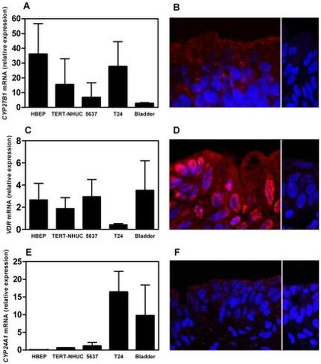 VDR Antibody in Immunocytochemistry, Immunohistochemistry (ICC/IF, IHC)