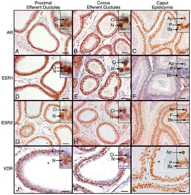 VDR Antibody in Immunohistochemistry (IHC)