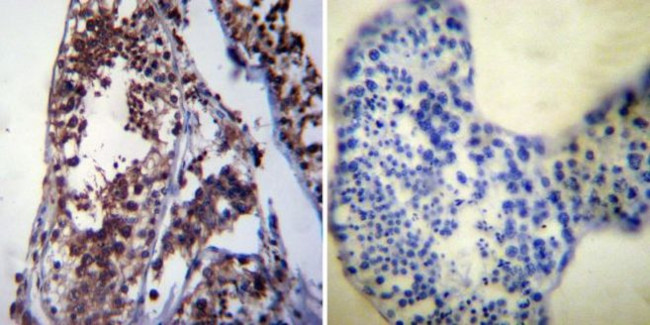 HSP70 Antibody in Immunohistochemistry (Paraffin) (IHC (P))