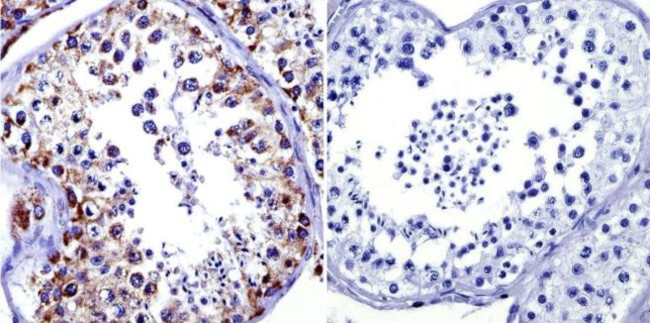 mtHSP70 Antibody in Immunohistochemistry (Paraffin) (IHC (P))