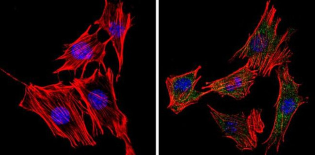 Phospholamban Antibody in Immunocytochemistry (ICC/IF)