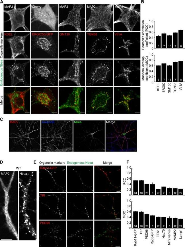 mtHSP70 Antibody in Immunohistochemistry (IHC)