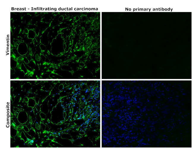 Vimentin Antibody in Immunohistochemistry (Paraffin) (IHC (P))