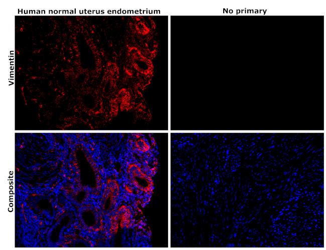 Vimentin Antibody in Immunohistochemistry (Paraffin) (IHC (P))