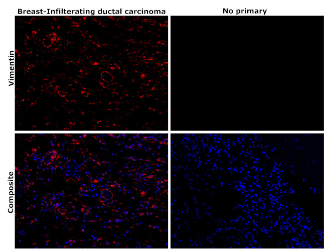 Vimentin Antibody in Immunohistochemistry (Paraffin) (IHC (P))