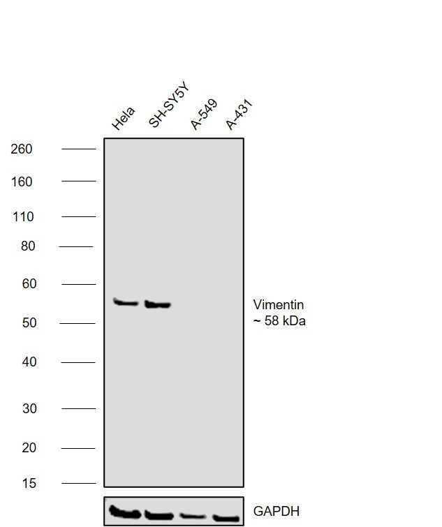 Vimentin Antibody