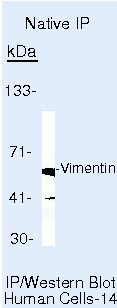 Vimentin Antibody in Immunoprecipitation (IP)