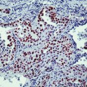 Nkx2.1 Antibody in Immunohistochemistry (Paraffin) (IHC (P))