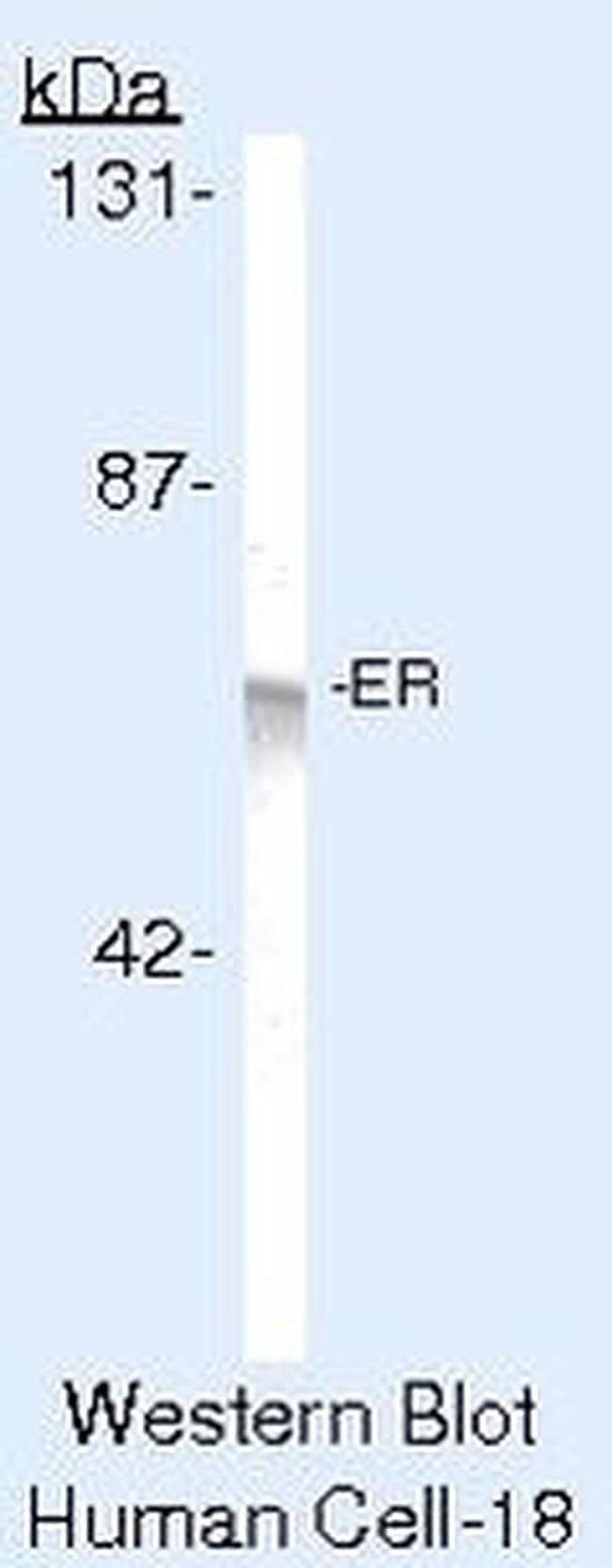 Estrogen Receptor alpha Antibody in Western Blot (WB)