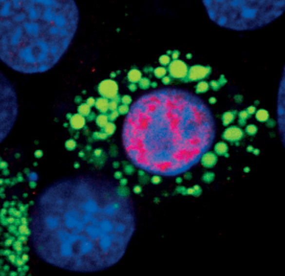 PPAR gamma Antibody in Immunocytochemistry (ICC/IF)