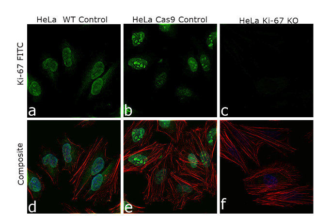 Ki-67 Antibody in Immunocytochemistry (ICC/IF)