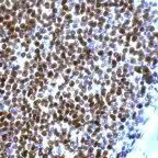 Cyclin D1 Antibody in Immunohistochemistry (Paraffin) (IHC (P))