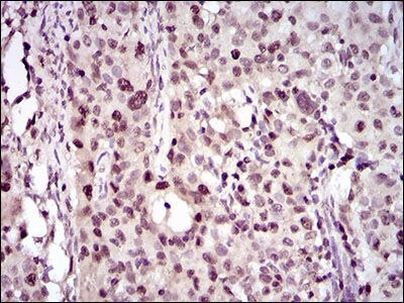 PCNA Antibody in Immunohistochemistry (Paraffin) (IHC (P))