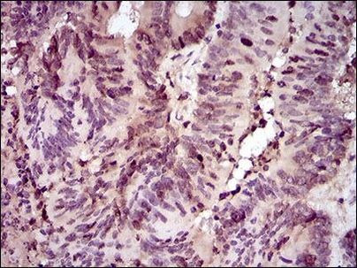 PCNA Antibody in Immunohistochemistry (Paraffin) (IHC (P))