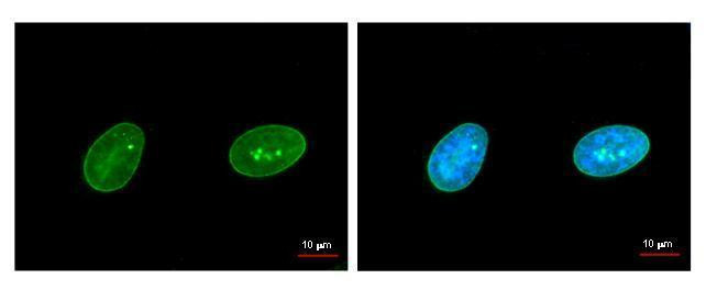 Lamin A/C Antibody in Immunocytochemistry (ICC/IF)