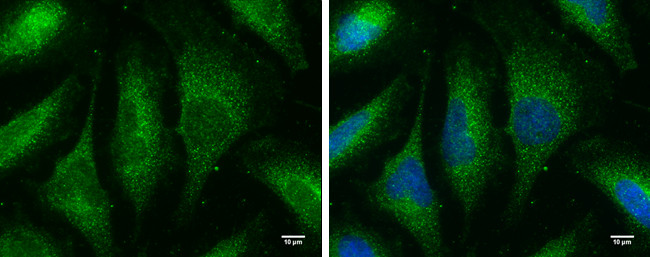 MX1 Antibody in Immunocytochemistry (ICC/IF)