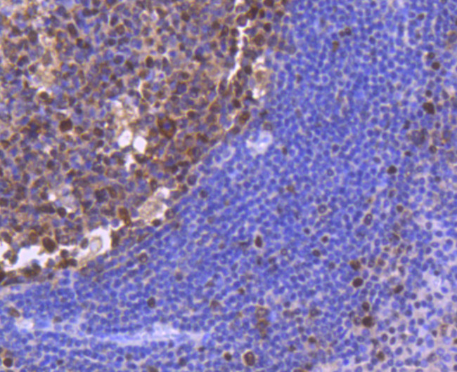 PCNA Antibody in Immunohistochemistry (Paraffin) (IHC (P))