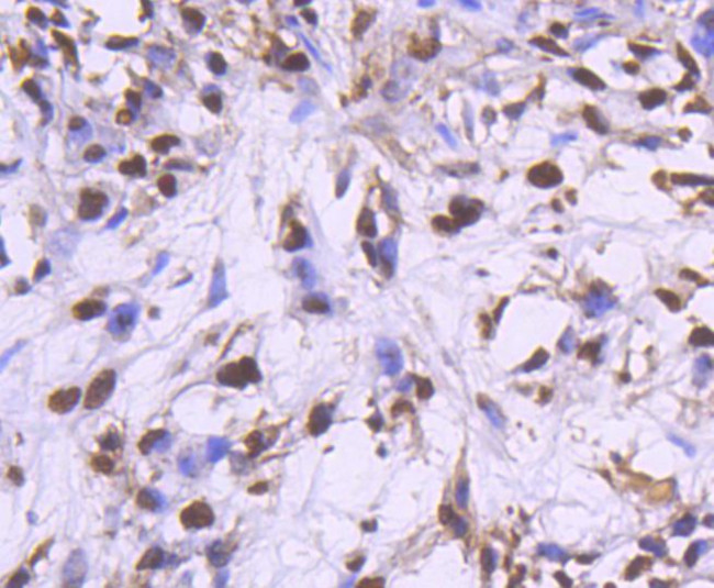 PCNA Antibody in Immunohistochemistry (Paraffin) (IHC (P))