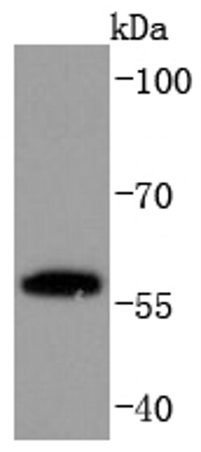 PPAR gamma Antibody in Western Blot (WB)