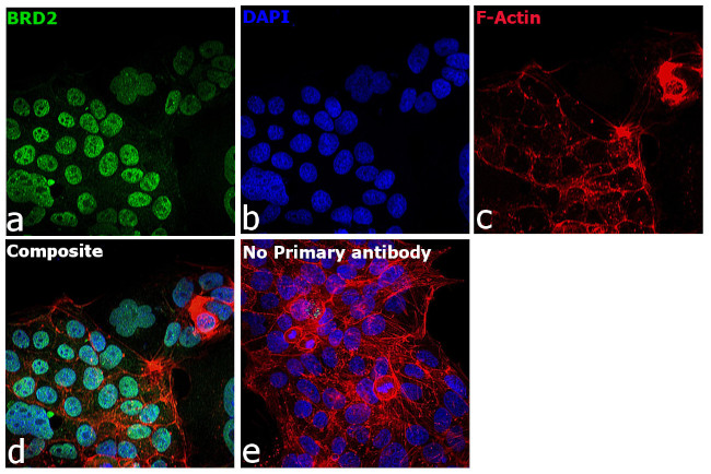 BRD2 Antibody in Immunocytochemistry (ICC/IF)