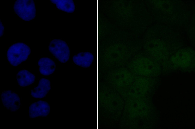 BRD2 Antibody in Immunocytochemistry (ICC/IF)