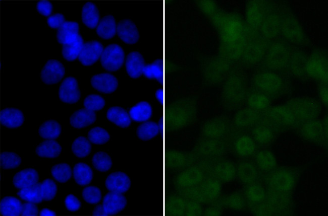 BRD2 Antibody in Immunocytochemistry (ICC/IF)