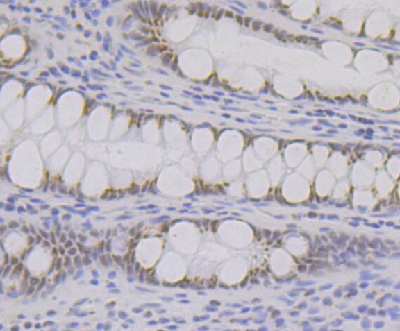 BRD2 Antibody in Immunohistochemistry (Paraffin) (IHC (P))