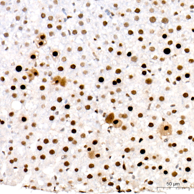 PCNA Antibody in Immunohistochemistry (Paraffin) (IHC (P))