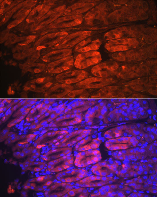 NQO1 Antibody in Immunohistochemistry (Paraffin) (IHC (P))