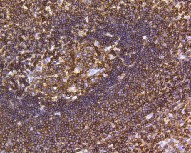 CD45 Antibody in Immunohistochemistry (Paraffin) (IHC (P))