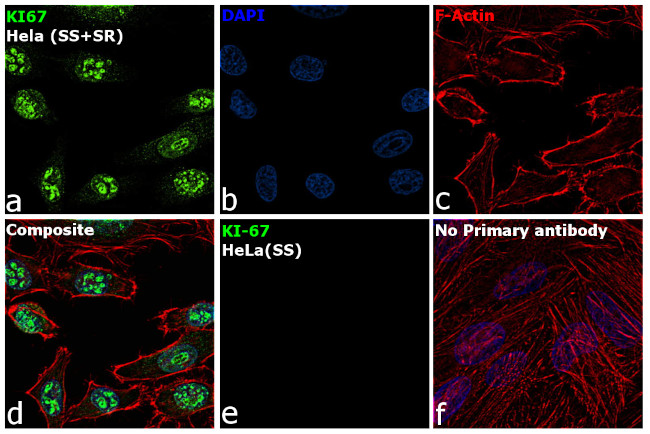 Ki-67 Antibody in Immunocytochemistry (ICC/IF)