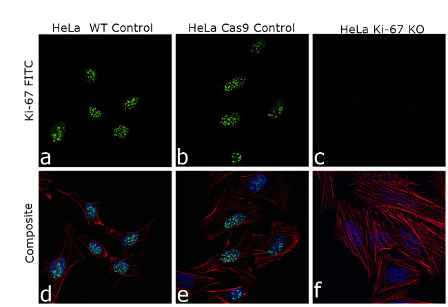 Ki-67 Antibody in Immunocytochemistry (ICC/IF)