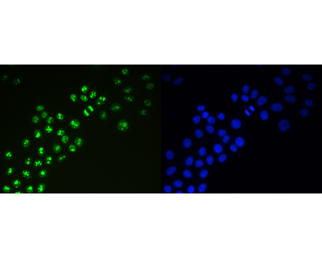 Ki-67 Antibody in Immunocytochemistry (ICC/IF)