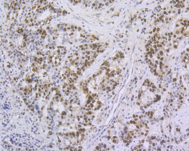 Ki-67 Antibody in Immunohistochemistry (Paraffin) (IHC (P))