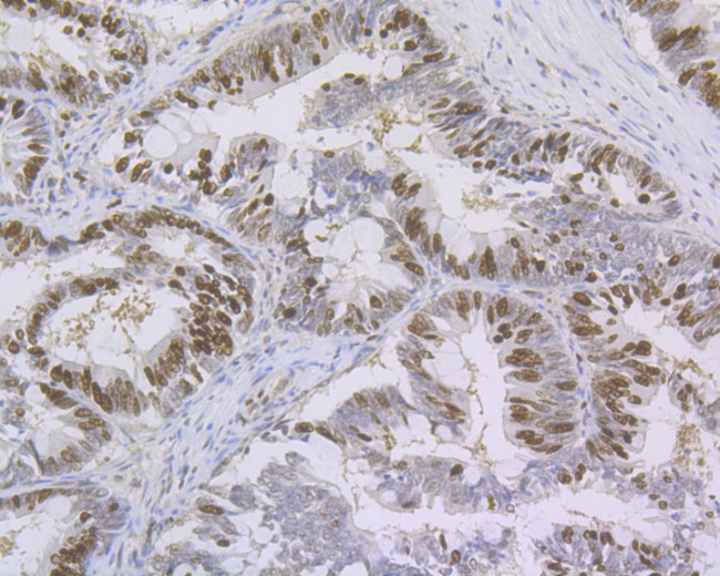 Ki-67 Antibody in Immunohistochemistry (Paraffin) (IHC (P))