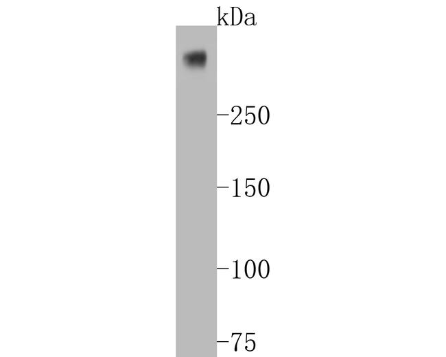 Ki-67 Antibody in Western Blot (WB)