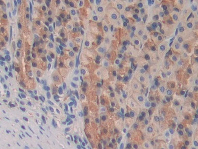 PPAR gamma Antibody in Immunohistochemistry (Paraffin) (IHC (P))