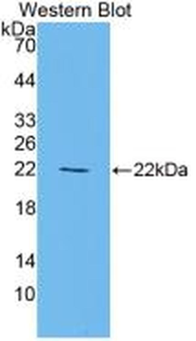 PPAR gamma Antibody in Western Blot (WB)