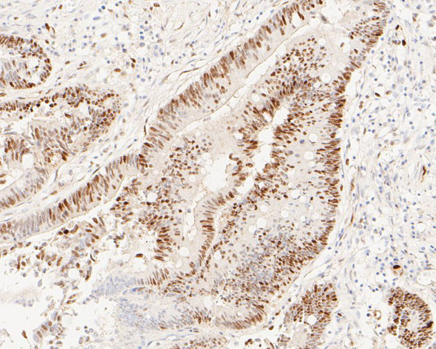 Cyclin D1 Antibody in Immunohistochemistry (Paraffin) (IHC (P))