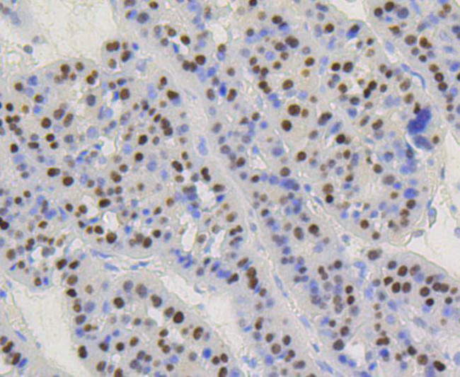 Cyclin D1 Antibody in Immunohistochemistry (Paraffin) (IHC (P))