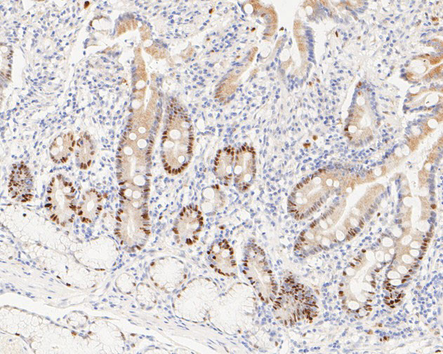 Cyclin D1 Antibody in Immunohistochemistry (Paraffin) (IHC (P))