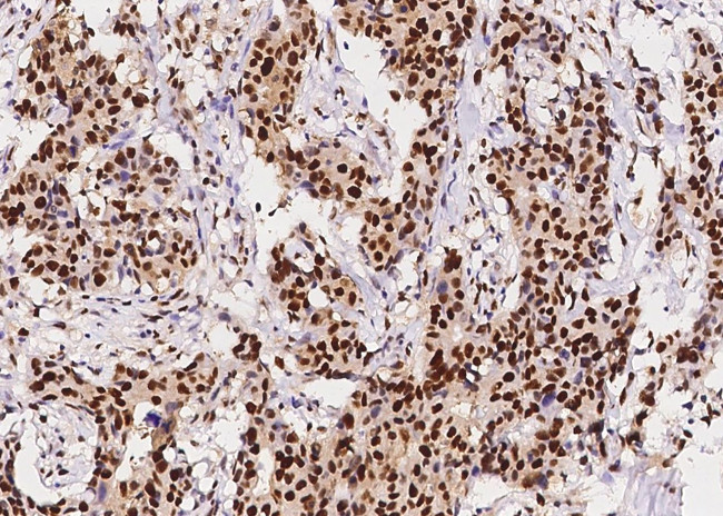 PCNA Antibody in Immunohistochemistry (Paraffin) (IHC (P))