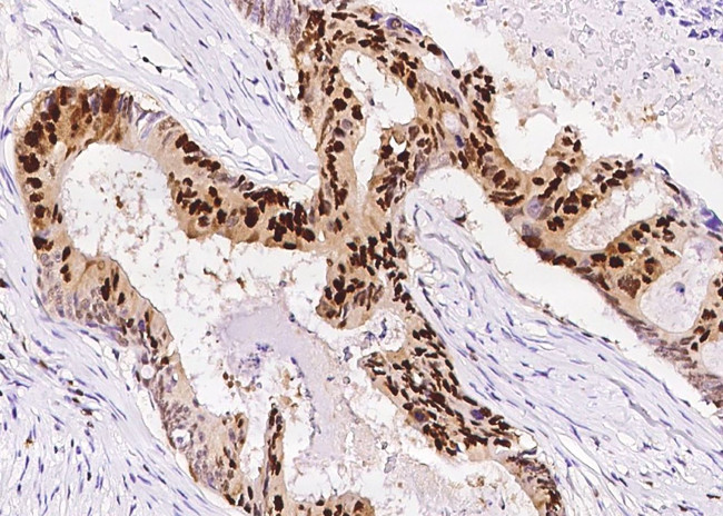 PCNA Antibody in Immunohistochemistry (Paraffin) (IHC (P))